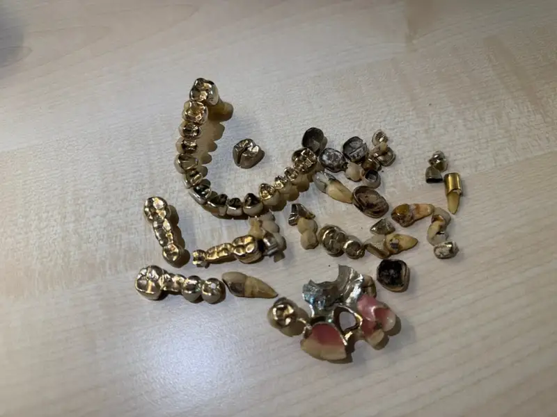 Kundenfoto: Zahngold, Kronen und Brückenteile auf einer hellen Holzoberfläche